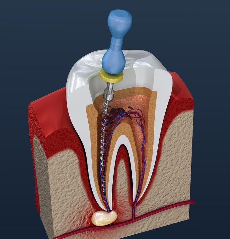 Dr Jobs Dental Care Edakkara