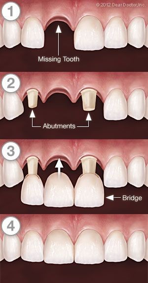 Dr Jobs Dental Care Edakkara